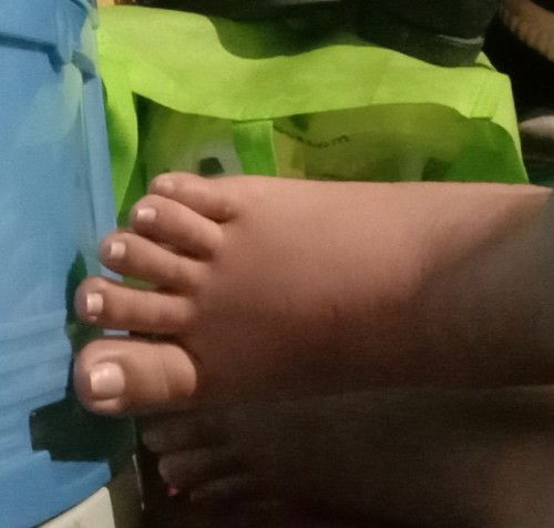 37weeks &5days preggy.