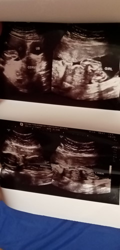 Mga mi sa utz ko baby girl mai possibilities ba na magbago 22 weeks yan dpa kase nakakabili ng gamit