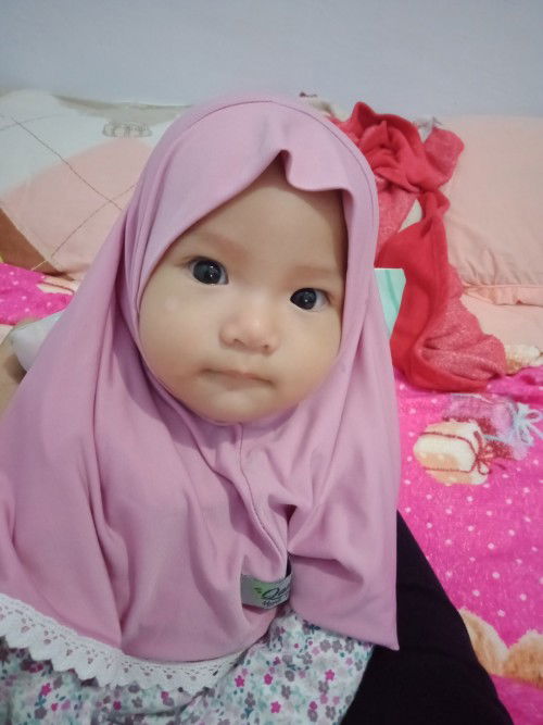 Bun, ada yg tau ngak obat putih di muka anak ku. Udh tnya dokter umum kata nya bukan panu.