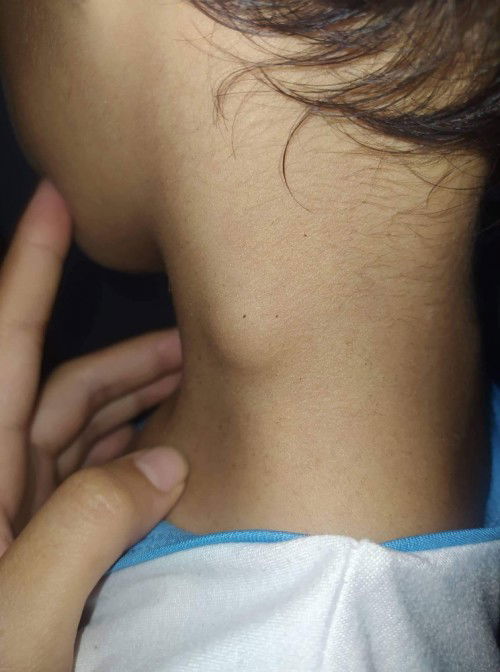 kulani po ba to bigla kasi tumobo nung nagkaubo sya ng matigasthis week papa check up narin po sya