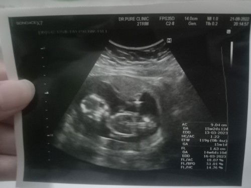 ผญ. หรือ ผช.