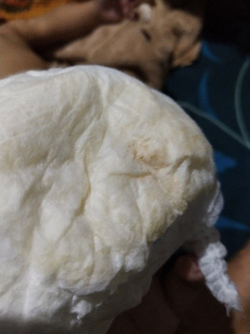 Pipis yang normal pada anak