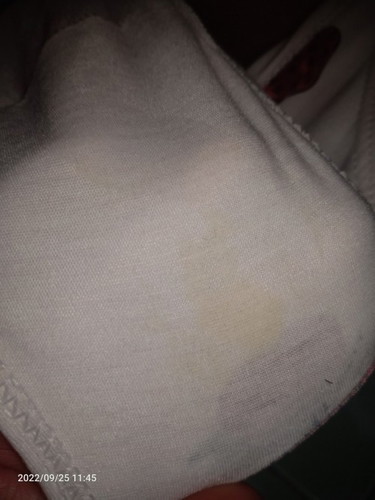 Yellowest discharge