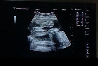 27w4dยังไม่รู้เพศเลยค่ะ