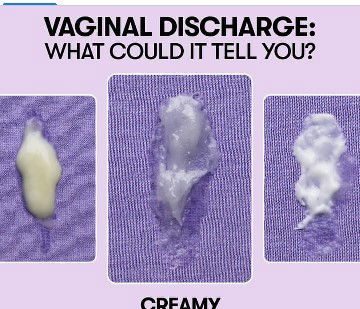 Nagkaganito rin ba kayo mga momsh? Habang buntis? Bakit Kaya may ganito ? Delikado ba to sa baby??