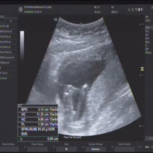 แม่ช่วยดูหน่อยค่ะ แบบนี้น่าจะเป็น ชาย หรือ หญิงคะ