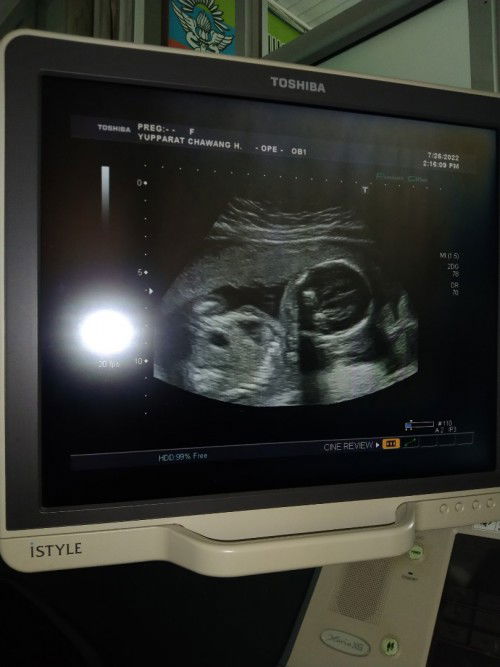 สอบถามหน่อยค่ะ แบบนี้เพศหญิงหรือเพศชายคะ...