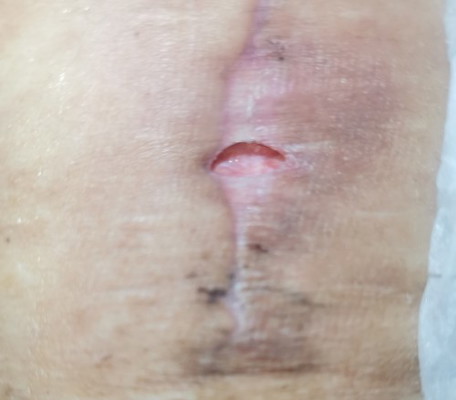 Mga mii pahelp po pls natatakot na kasi ako prang lumalaki butas. Sept 11 ako nangank.