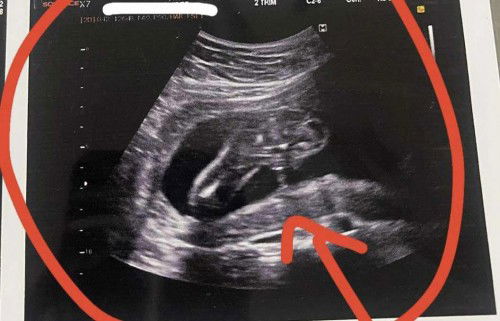 สอบถามแม่ๆหน่อยค่ะ