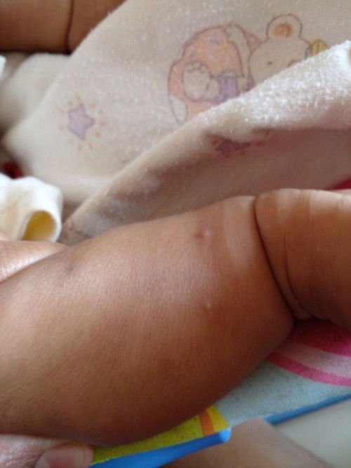 Bintik merah di kaki