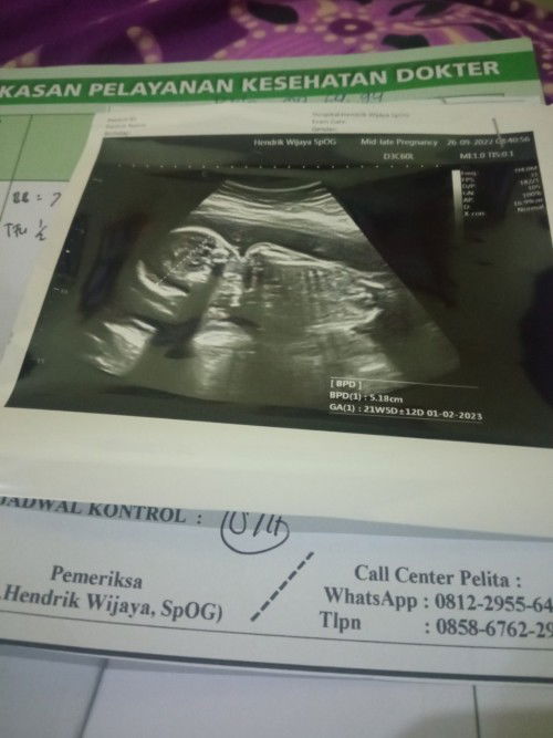 Plasenta mendekati jalan lahir