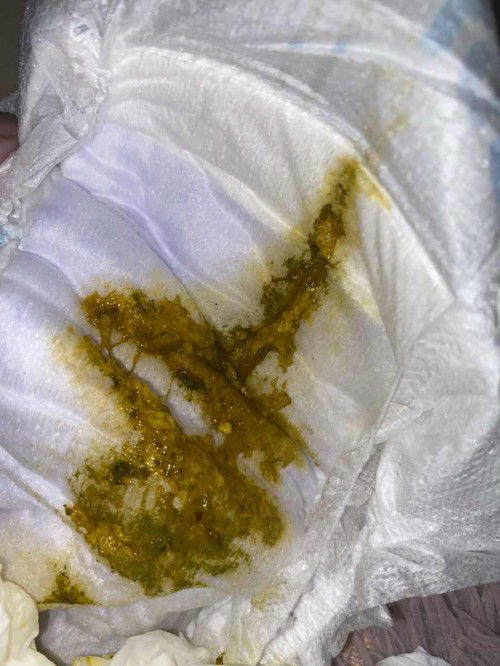 Nak tnye normal ke baby 2 bulan berak maaf kotor sikit