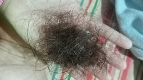 Hair fall nag alala po ako ka c ang dami
