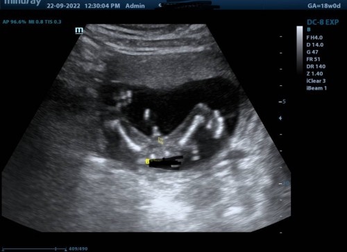 Gender Scan