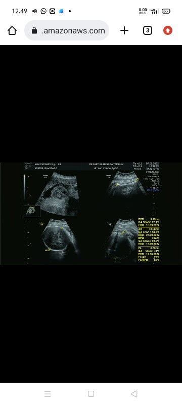 Bun aku mau nny dong kira2 ini hplnya kapan ya😩soalnya kalo dr bidan 28-29 September, terimakasih🙏