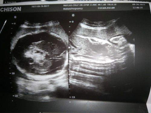 Share ko lang mi😔