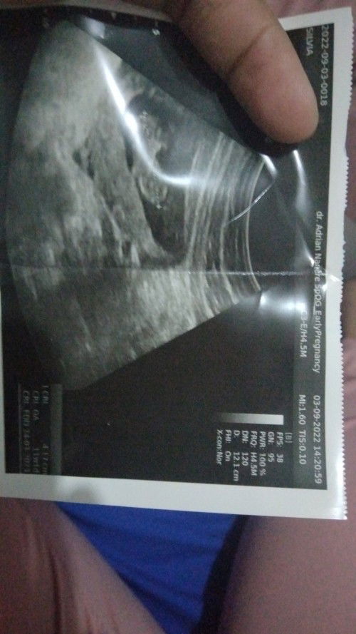 Ingin tau jenis kelamin