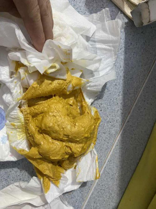 Cân nhắc xem hình nếu đăg ăn 8 ngày bé k đi ị