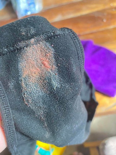 อันตรายไหมค่ะ