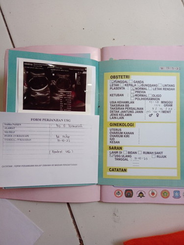 Aku mah selalu merasakan perut sakit,melilit,mules,kram,sakit yg begitu ga enak bgt?
Kenapa ya..