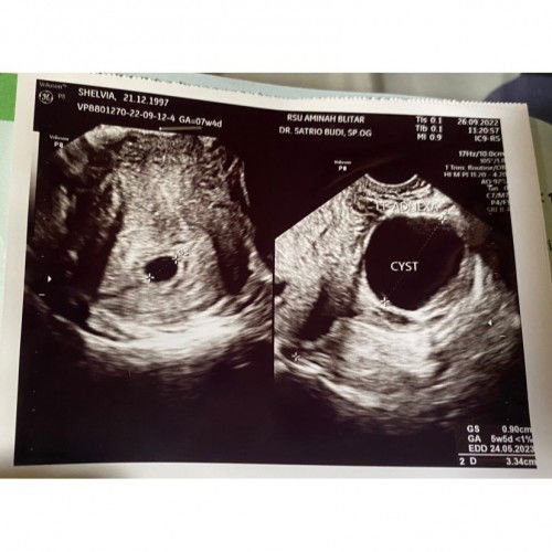 Mohon sharingnya bunda🙏🏼