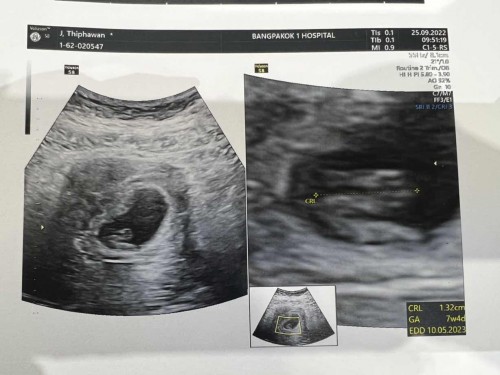 Welcome to Baby
