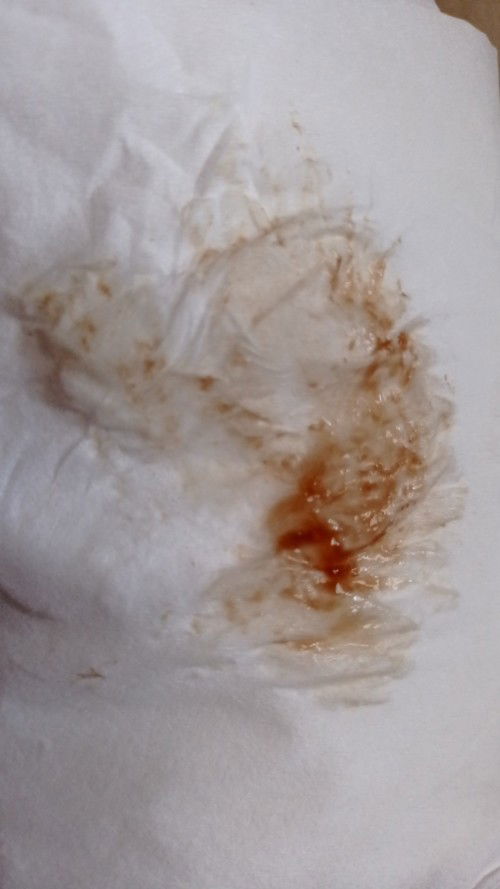 35mg hamil anak pertama