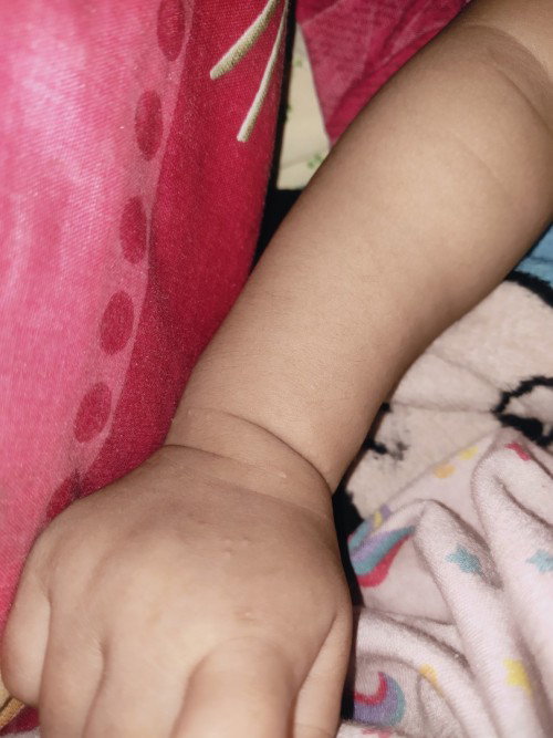 Mom cara hilangin biang keringat gimana ya, sarannya dong, kasian anak saya udah 1 badan biangnya