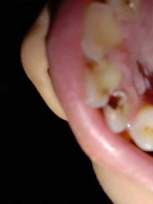 ปวดฟันควรทำอย่างไร