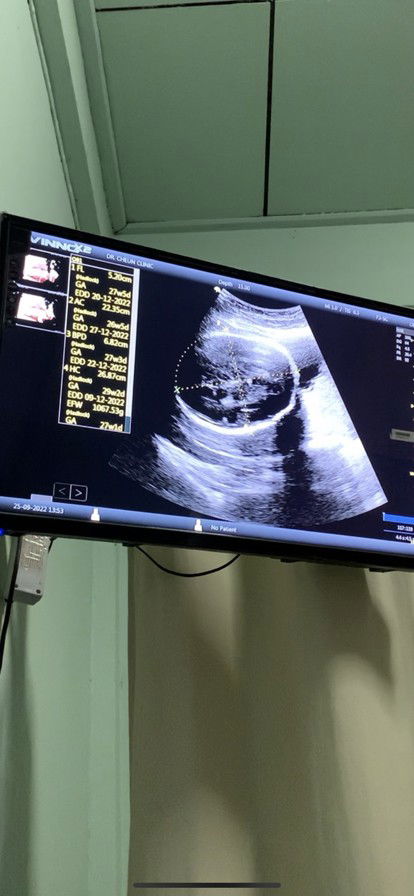 น้อง 28 วีค หัวไม่กลม