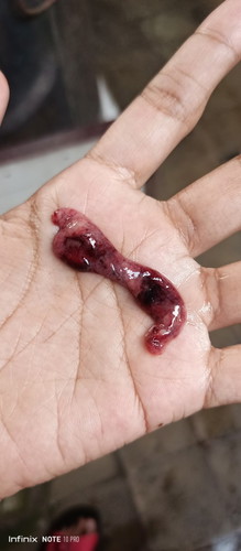 Ya allah bun aku barusan keluaran ini 😭perut dari pgi mules aku pke softek seperti yg haid