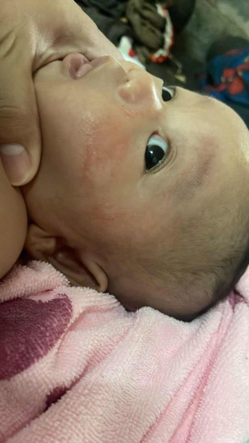 ขอคำปรึกษาแม่ๆหนาค่ะ🙏🏻🙏🏻