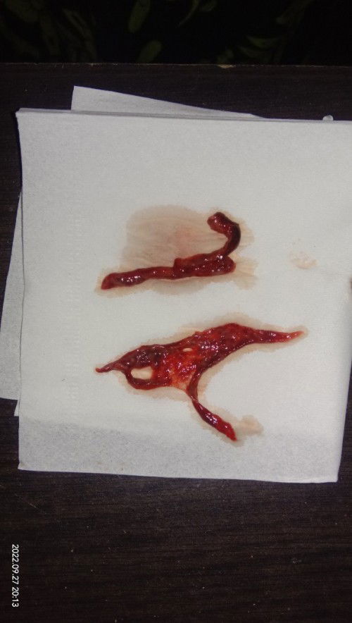 Tespek negative keluar jaringan