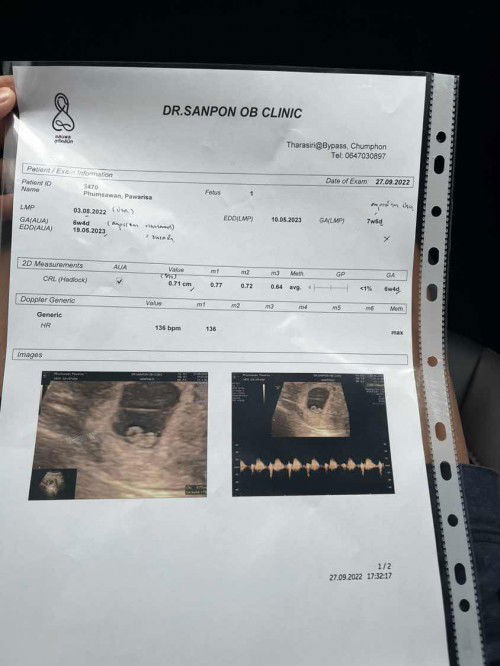 สอบถามแม่ๆที่มีประสบการณ์นะคะ