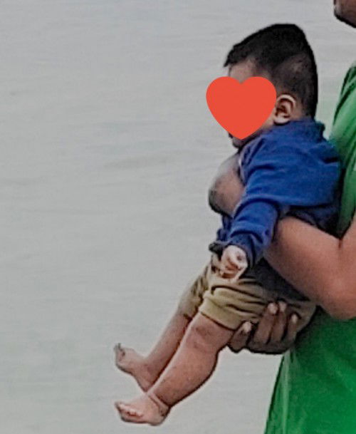 Kepala bayi gepeng/peyang