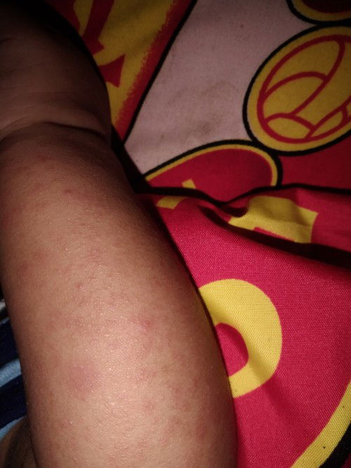 Assalamualaikum bund mau tanya ,tolong di jawab yah bunda 🙏🏻🥺saya minta bantuan nya