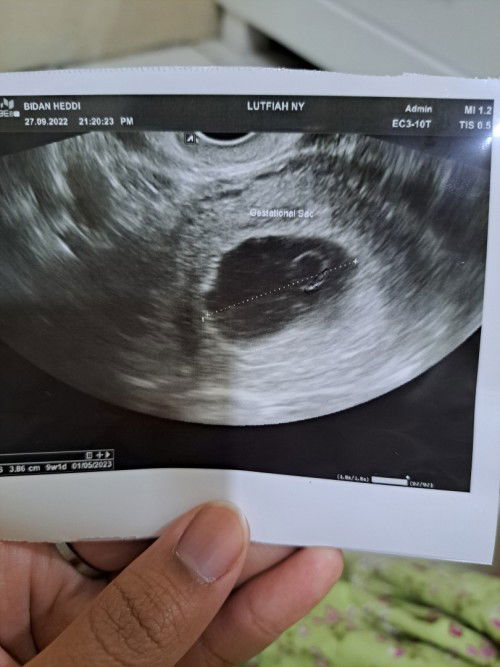 Hamil kosong usia 9week