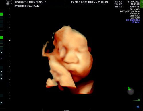 ❤️❤️❤️❤️❤️😭😭😭😭😭