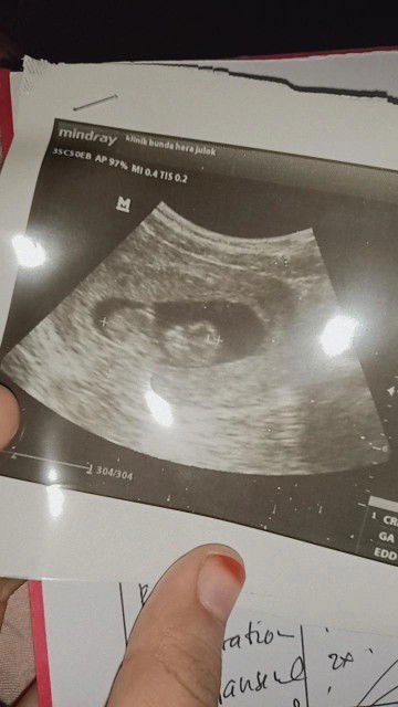 Tips menaikkan berat badan