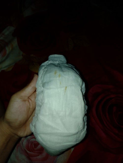 Bercak hijau pada Pampers bayi
