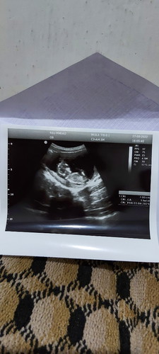 Usg 13w masya Allah bahagia banget bun lihat perkembangan babynya,terharu krna hamil pertama..
