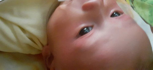 Merah di sekitaran wajah