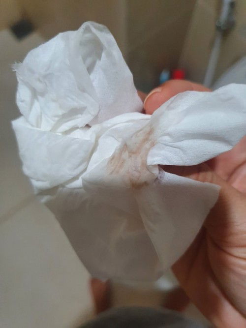 24  W มีตกขาวปนเลือดจางๆ  แบบนี้อันตรายมั้ยคะ  ไม่ปวดท้องไม่ได้ยกของหนัก อยู่ดีๆ  ก้เป็น