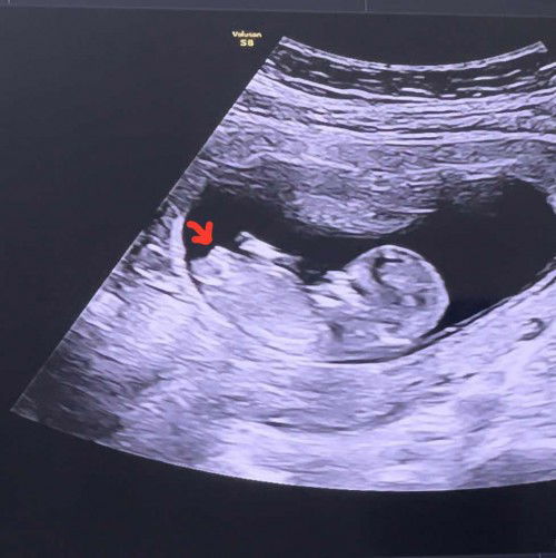 ช่วยแม่ผมดูหน่อย.. 🥰