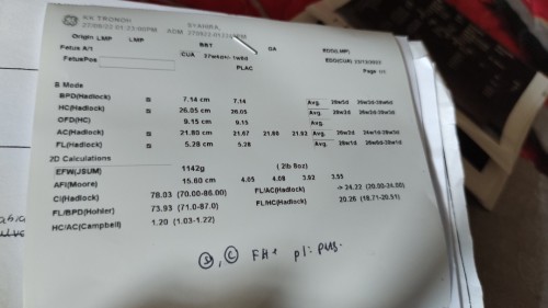 Scan perut baby kecik