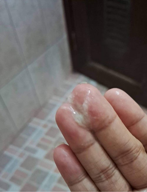 37 weeks 4days discharge