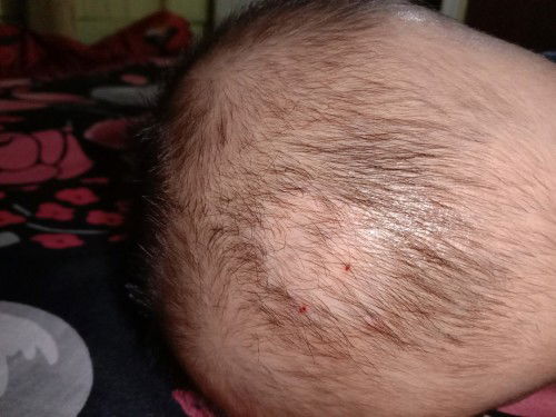 Bunda apa ada yang pernah mengalami nya