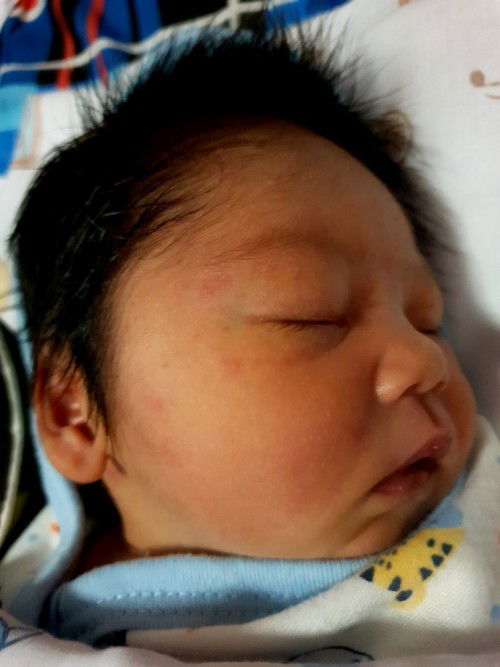 มันคือผื่นอะไร