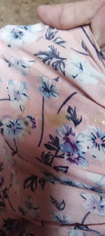 มูกหรือเปล่าคะ