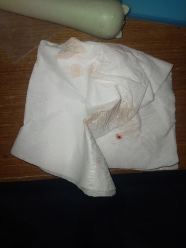 สอบถามแม่ๆคะ